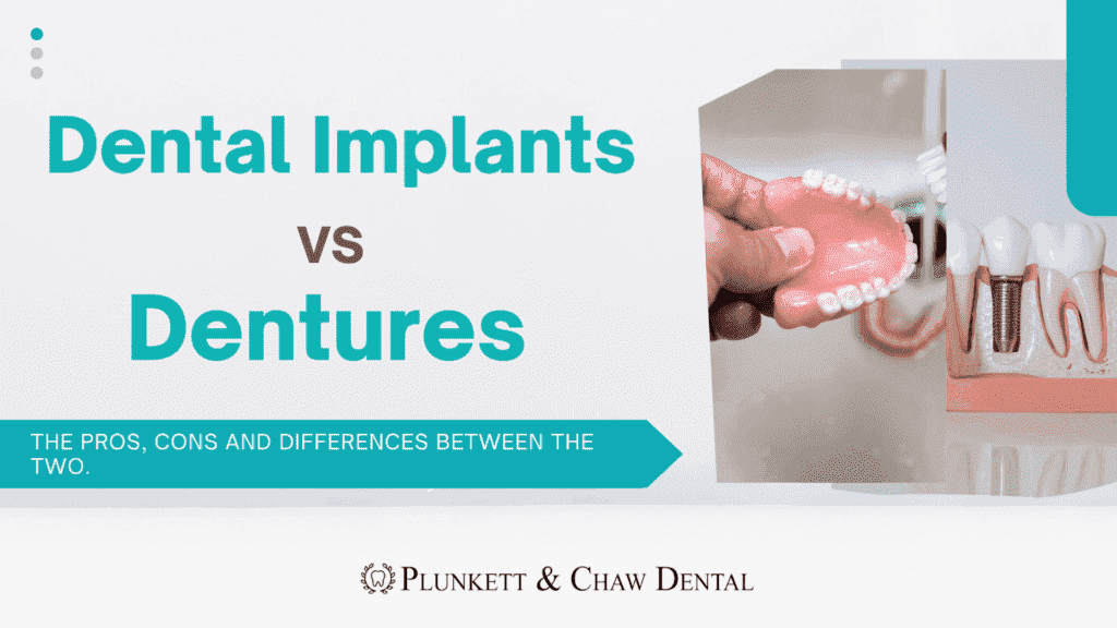 dental implants vs dentures