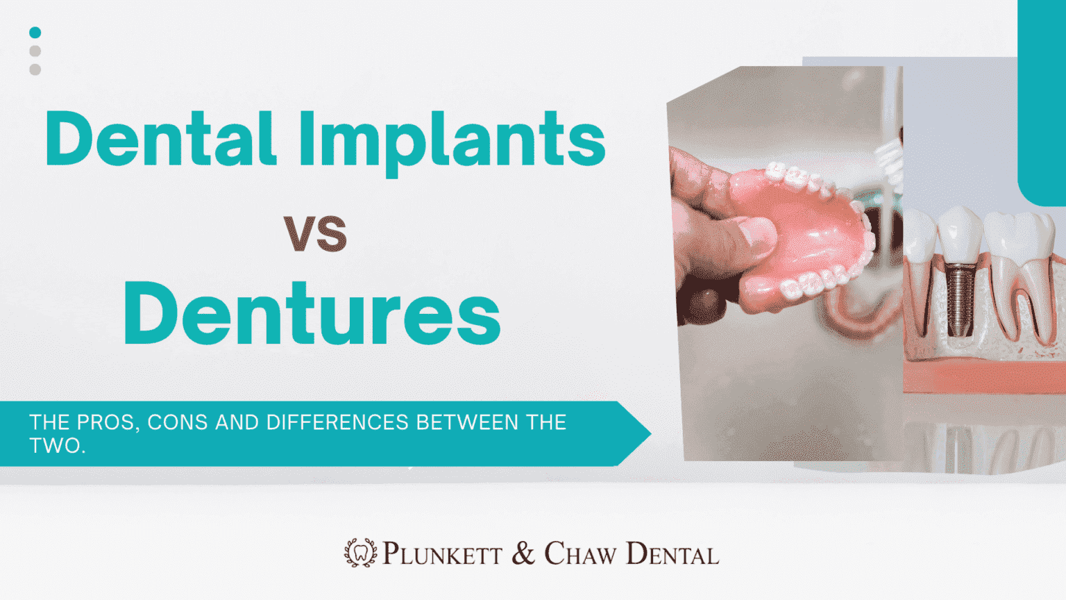 Just the Thing Missing From Your Life? Dental Implants vs Dentures