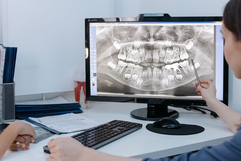 Dentist and patient reviewing a dental X-ray to plan implant treatment and estimate overall cost