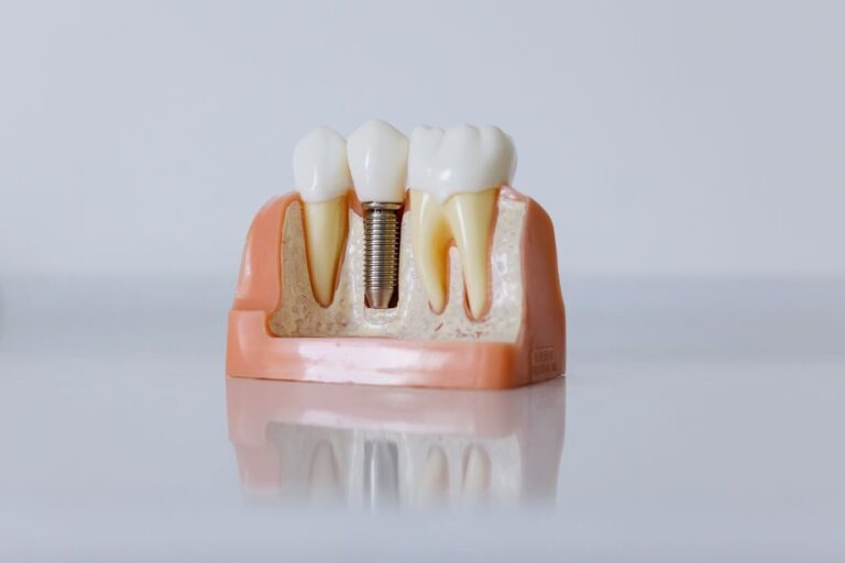 Dentist showing a patient a dental implant model while discussing average cost of dental implants in Atlanta