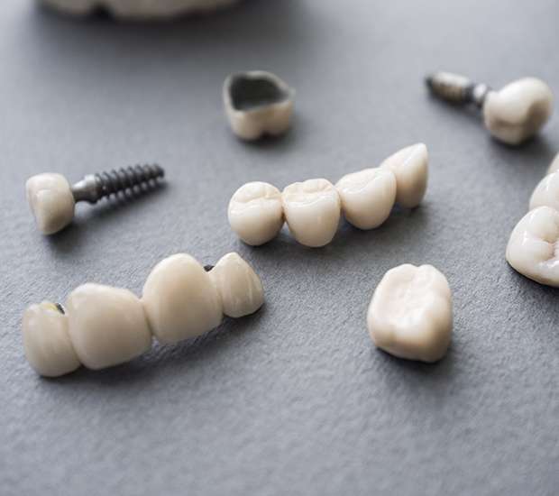 Dunwoody The Difference Between Dental Implants and Mini Dental Implants