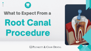 Illustration of tooth root canal treatment showing what to expect from a root canal procedure